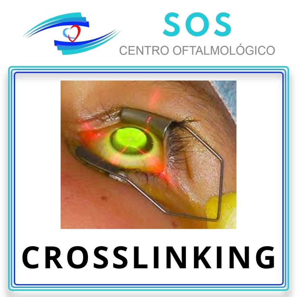 Crosslinking