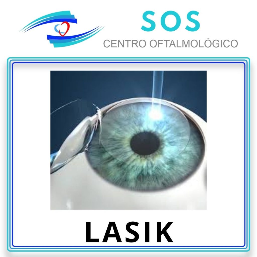 Cirugía Lasik