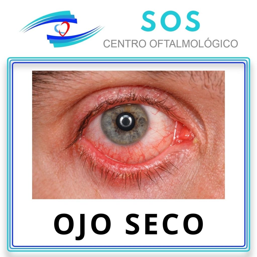 Ojo Seco