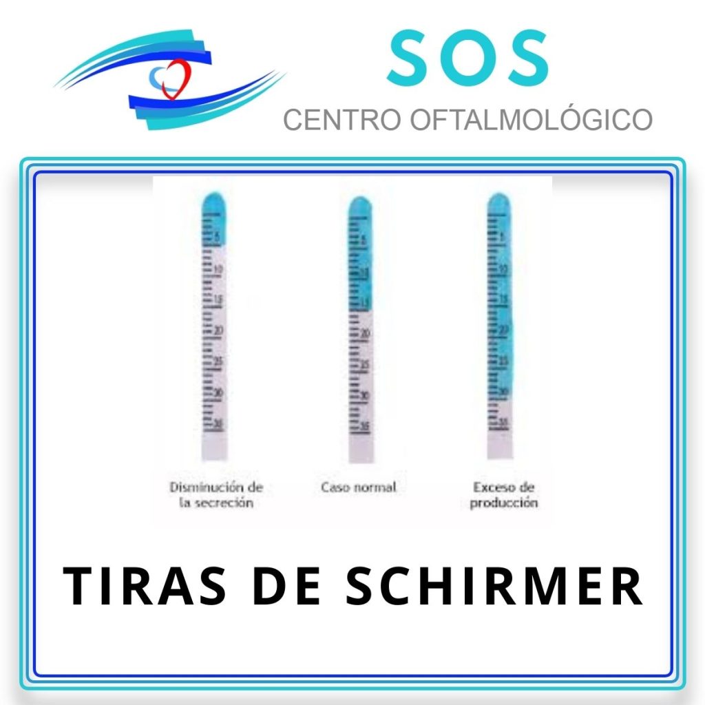 Tiras con las que se realiza el Test de Shirmer