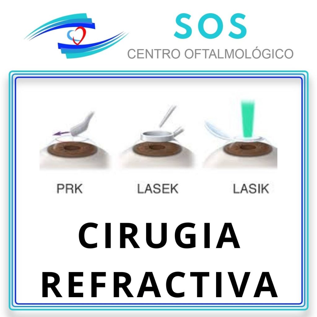 Cirugías Refractivas