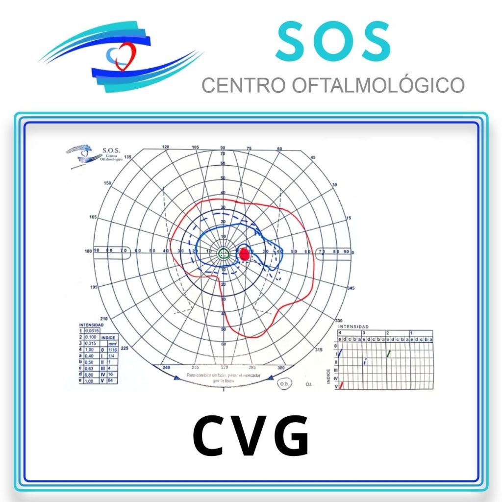 Informe CVG