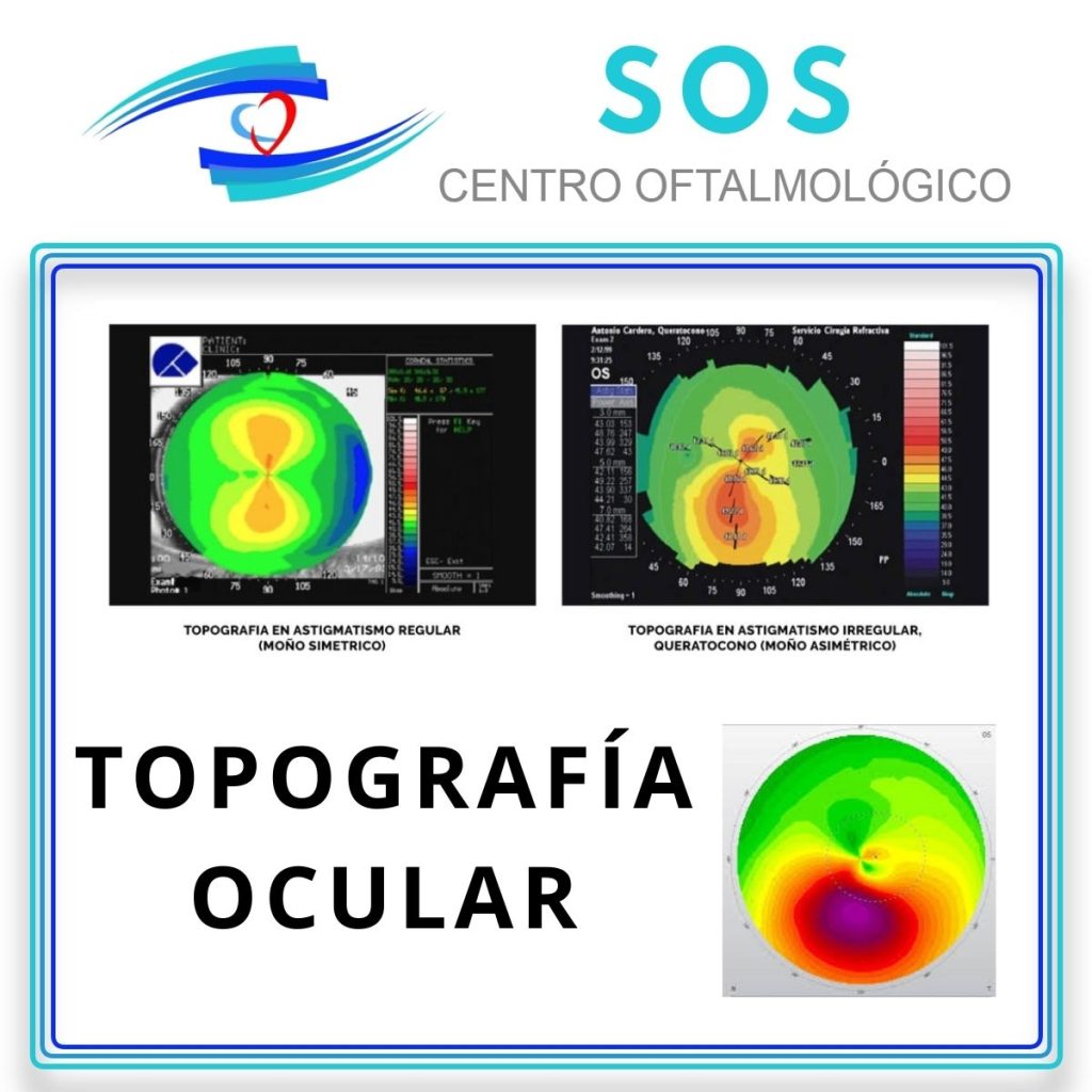 Así es el formato del informe de la Topografía 