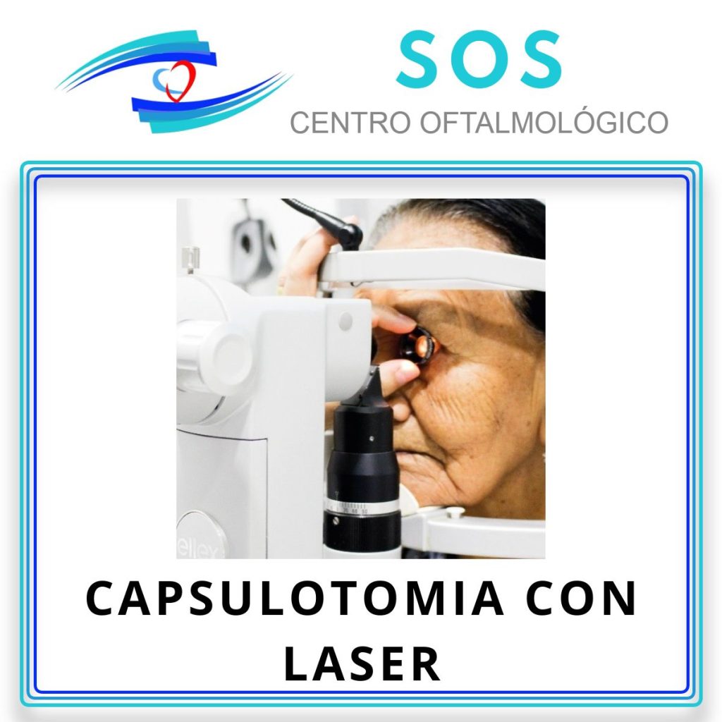 Capsulotomía con Láser